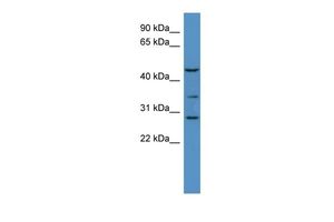 Anti-B3galt2 antibody, C-term used in Western blot. GTX44689
