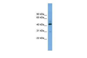 Anti-B4GALT2 antibody, Internal used in Western blot. GTX46702