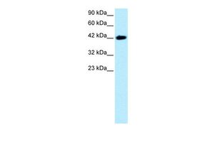 Anti-BARHL2 antibody, Internal used in Western blot. GTX77863