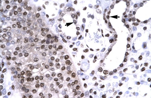 Anti-BARHL2 antibody, Internal used in IHC (Formalin-fixed paraffin-embedded sections). GTX77863