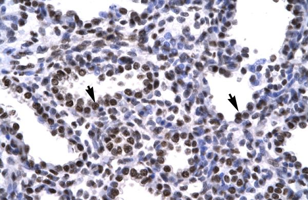 Anti-BARHL2 antibody, Internal used in IHC (Formalin-fixed paraffin-embedded sections). GTX77863