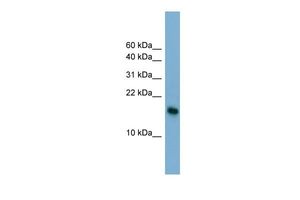 Anti-BATF3 antibody, N-term used in Western blot. GTX44669