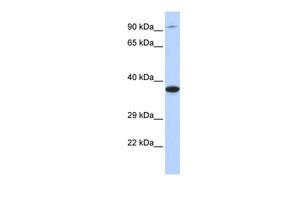 Anti-BBS5 antibody, Internal used in Western blot. GTX45664