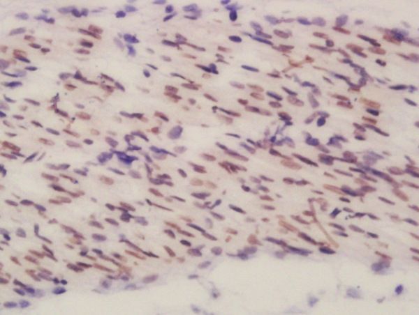 Anti-BEND3 antibody used in IHC (Formalin-fixed paraffin-embedded sections). GTX51985
