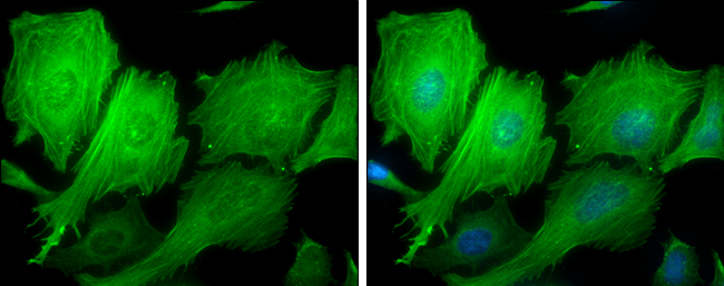 Anti-beta Actin antibody used in Immunocytochemistry/ Immunofluorescence. GTX100313