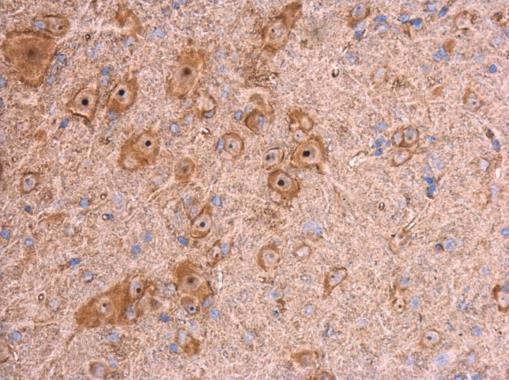 Anti-beta Actin antibody used in IHC (Formalin-fixed paraffin-embedded sections). GTX109639