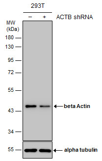Anti-beta Actin antibody used in Western blot. GTX109639