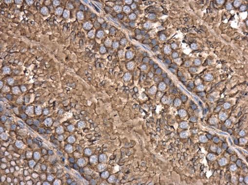 Anti-beta Actin antibody used in IHC (Formalin-fixed paraffin-embedded sections). GTX109639