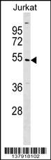 UBE2Q1 Antibody (N-term) (Cat. #AP17537a) western blot analysis in Jurkat cell line lysates (35ug/lane).This demonstrates the UBE2Q1 antibody detected the UBE2Q1 protein (arrow).