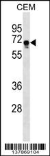 FEM1C Antibody (C-term) (Cat. #AP17534b) western blot analysis in CEM cell line lysates (35ug/lane).This demonstrates the FEM1C antibody detected the FEM1C protein (arrow).