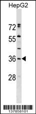 ERP27 Antibody (C-term) (Cat. #AP17528b) western blot analysis in HepG2 cell line lysates (35ug/lane).This demonstrates the ERP27 antibody detected the ERP27 protein (arrow).