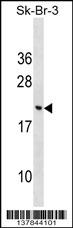 CNIH3 Antibody (N-term) (Cat. #AP17519a) western blot analysis in SK-BR-3 cell line lysates (35ug/lane).This demonstrates the CNIH3 antibody detected the CNIH3 protein (arrow).