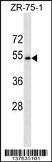 CCDC112 Antibody (N-term) (Cat. #AP17513a) western blot analysis in ZR-75-1 cell line lysates (35ug/lane).This demonstrates the CCDC112 antibody detected the CCDC112 protein (arrow).