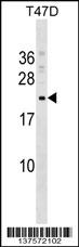 COMMD9 Antibody (C-term) (Cat. #AP17500b) western blot analysis in T47D cell line lysates (35ug/lane).This demonstrates the COMMD9 antibody detected the COMMD9 protein (arrow).