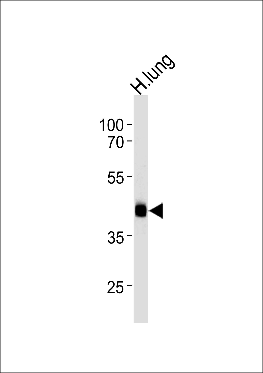 Western blot analysis of lysate from human lung tissue lysate, using MTRF1 Antibody (Center)(Cat. #AP17473c). AP17473c was diluted at 1:1000 at each lane. A goat anti-rabbit IgG H&L(HRP) at 1:5000 dilution was used as the secondary antibody. Lysate at 35ug per lane.