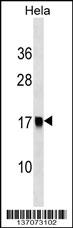 AP2S1 Antibody (Center) (Cat. #AP17428c) western blot analysis in Hela cell line lysates (35ug/lane).This demonstrates the AP2S1 antibody detected the AP2S1 protein (arrow).