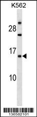 EMP1 Antibody (N-term) (Cat. #AP17400a) western blot analysis in K562 cell line lysates (35ug/lane).This demonstrates the EMP1 antibody detected the EMP1 protein (arrow).