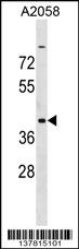 ADAT3 Antibody (N-term) (Cat. #AP17369a) western blot analysis in A2058 cell line lysates (35ug/lane).This demonstrates the ADAT3 antibody detected the ADAT3 protein (arrow).