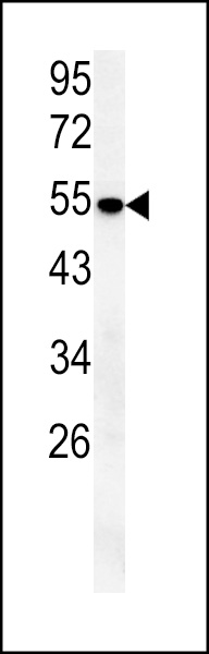 SLC43A2 Antibody (Center) (Cat. #AP10062c) western blot analysis in mouse lung tissue lysates (15ug/lane).This demonstrates the SLC43A2 antibody detected SLC43A2 protein (arrow).
