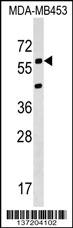 KCNS3 Antibody (N-term) (Cat. #AP17334a) western blot analysis in MDA-MB453 cell line lysates (35ug/lane).This demonstrates the KCNS3 antibody detected the KCNS3 protein (arrow).