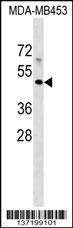 MR1 Antibody (C-term) (Cat. #AP17332b) western blot analysis in MDA-MB453 cell line lysates (35ug/lane).This demonstrates the MR1 antibody detected the MR1 protein (arrow).