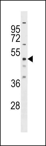 RBM23 Antibody (Center) (Cat. #AP17329c) western blot analysis in Hela cell line lysates (35ug/lane).This demonstrates the RBM23 antibody detected the RBM23 protein (arrow).