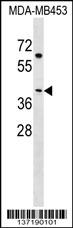 NECAB2 Antibody (N-term) (Cat. #AP17328a) western blot analysis in MDA-MB453 cell line lysates (35ug/lane).This demonstrates the NECAB2 antibody detected the NECAB2 protein (arrow).