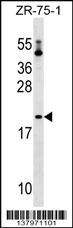 PTRH1 Antibody (Center) (Cat. #AP17745c) western blot analysis in ZR-75-1 cell line lysates (35ug/lane).This demonstrates the PTRH1 antibody detected the PTRH1 protein (arrow).