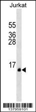 PATE1 Antibody (C-term) (Cat. #AP17742b) western blot analysis in Jurkat cell line lysates (35ug/lane).This demonstrates the PATE1 antibody detected the PATE1 protein (arrow).