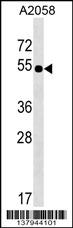 NHEDC2 Antibody (C-term) (Cat. #AP17738b) western blot analysis in A2058 cell line lysates (35ug/lane).This demonstrates the NHEDC2 antibody detected the NHEDC2 protein (arrow).