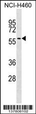 UGT2A3 Antibody (Center) (Cat. #AP17728c) western blot analysis in NCI-H460 cell line lysates (35ug/lane).This demonstrates the UGT2A3 antibody detected the UGT2A3 protein (arrow).