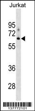 XYLB Antibody (N-term) (Cat. #AP17718a) western blot analysis in Jurkat cell line lysates (35ug/lane).This demonstrates the XYLB antibody detected the XYLB protein (arrow).