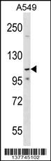 PHF20L1 Antibody (C-term) (Cat. #AP17708b) western blot analysis in A549 cell line lysates (35ug/lane).This demonstrates the PHF20L1 antibody detected the PHF20L1 protein (arrow).