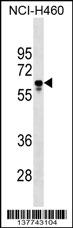 PGS1 Antibody (Center) (Cat. #AP17706c) western blot analysis in NCI-H460 cell line lysates (35ug/lane).This demonstrates the PGS1 antibody detected the PGS1 protein (arrow).