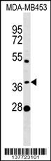 MTHFSD Antibody (N-term) (Cat. #AP17699a) western blot analysis in MDA-MB453 cell line lysates (35ug/lane).This demonstrates the MTHFSD antibody detected the MTHFSD protein (arrow).