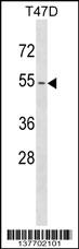 KRT79 Antibody (Center) (Cat. #AP17691c) western blot analysis in T47D cell line lysates (35ug/lane).This demonstrates the KRT79 antibody detected the KRT79 protein (arrow).