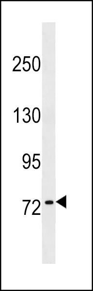 KHNYN Antibody (C-term) (Cat. #AP17690b) western blot analysis in NCI-H292 cell line lysates (35ug/lane).This demonstrates the KHNYN antibody detected the KHNYN protein (arrow).
