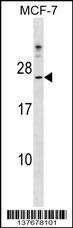 CYB5D1 Antibody (Center) (Cat. #AP17685c) western blot analysis in MCF-7 cell line lysates (35ug/lane).This demonstrates the CYB5D1 antibody detected the CYB5D1 protein (arrow).