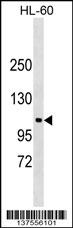 NDST3 Antibody (C-term) (Cat. #AP17676b) western blot analysis in HL-60 cell line lysates (35ug/lane).This demonstrates the NDST3 antibody detected the NDST3 protein (arrow).