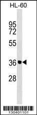 ZNF785 Antibody (N-term) (Cat. #AP17645a) western blot analysis in HL-60 cell line lysates (35ug/lane).This demonstrates the ZNF785 antibody detected the ZNF785 protein (arrow).