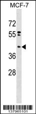 PPAPDC2 Antibody (N-term) (Cat. #AP17641a) western blot analysis in MCF-7 cell line lysates (35ug/lane).This demonstrates the PPAPDC2 antibody detected the PPAPDC2 protein (arrow).