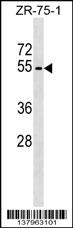 PLD4 Antibody (N-term) (Cat. #AP17640a) western blot analysis in ZR-75-1 cell line lysates (35ug/lane).This demonstrates the PLD4 antibody detected the PLD4 protein (arrow).
