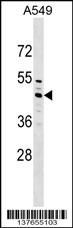 ZC3H10 Antibody (N-term) (Cat. #AP17613a) western blot analysis in A549 cell line lysates (35ug/lane).This demonstrates the ZC3H10 antibody detected the ZC3H10 protein (arrow).