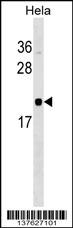 RWDD1 Antibody (N-term) (Cat. #AP17604a) western blot analysis in Hela cell line lysates (35ug/lane).This demonstrates the RWDD1 antibody detected the RWDD1 protein (arrow).