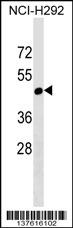 RGL4 Antibody (N-term) (Cat. #AP17597a) western blot analysis in NCI-H292 cell line lysates (35ug/lane).This demonstrates the RGL4 antibody detected the RGL4 protein (arrow).