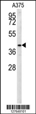 S35B2 Antibody (C-term) (Cat. #AP10039b) western blot analysis in A375 cell line lysates (35ug/lane).This demonstrates the S35B2 antibody detected the S35B2 protein (arrow).