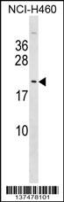 TTDN1 Antibody (C-term) (Cat. #AP17580b) western blot analysis in NCI-H460 cell line lysates (35ug/lane).This demonstrates the TTDN1 antibody detected the TTDN1 protein (arrow).