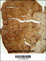 S35B2 antibody (C-term) (Cat. #AP10039b) immunohistochemistry analysis in formalin fixed and paraffin embedded human skeletal muscle followed by peroxidase conjugation of the secondary antibody and DAB staining. This data demonstrates the use of the S35B2 antibody (C-term) for immunohistochemistry. Clinical relevance has not been evaluated.