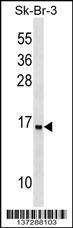 UTS2D Antibody (N-term) (Cat. #AP17577a) western blot analysis in SK-BR-3 cell line lysates (35ug/lane).This demonstrates the UTS2D antibody detected the UTS2D protein (arrow).