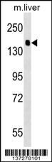 PPFIA2 Antibody (Center) (Cat. #AP17576c) western blot analysis in mouse liver tissue lysates (35ug/lane).This demonstrates the PPFIA2 antibody detected the PPFIA2 protein (arrow).